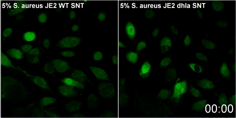 Nach Zugabe von bakteriellem Überstand (SNT), der α-Toxin enthält (links), wird eine anhaltend höhere Kalziumkonzentration sichtbar, was hietr durch die anhaltende grüne Fluoreszenz des Kalziumreporters belegt wird. Dies ist nicht der Fall bei SNT aus einer Mutante, der das porenbildende Toxin fehlt (rechts).
