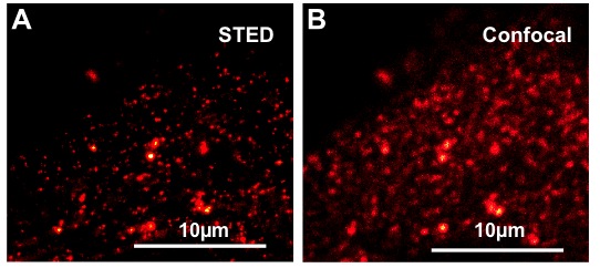 Visualisierung von Membrandomänen in Arabidopsis thaliana Epidermiszellen mit Hilfe des Markerproteins StREM1.3. Unter Zuhilfenahme hochauflösender mikroskopischer Methoden (links: STED-Mikroskopie; zum Vergleich rechts: konventionelle konfokale Fluoreszenzmikroskopie) können fluoreszenzmarkierte Proteine innerhalb scharf abgegrenzter Membranbereiche sichtbar gemacht werden (Zusammenarbeit mit G.S. Harms). Visualisierung von Membrandomänen in Arabidopsis thaliana Epidermiszellen mit Hilfe des Markerproteins StREM1.3.